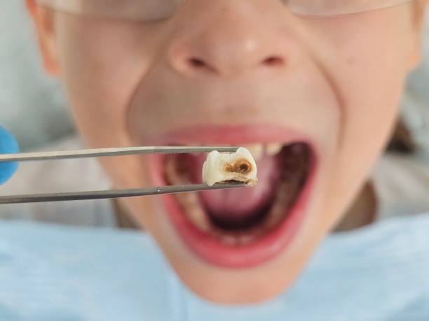 Best Emergency Dental Services for Seniors in Glenn Dale, MD