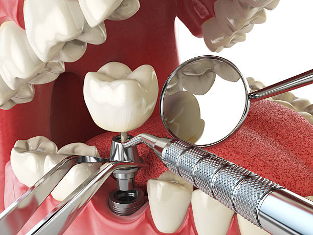 Best Emergency Dentist for Special Needs Patients in Glenn Dale, MD
